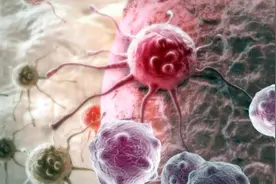 人发烧到43度，能不能杀死癌细胞？医生：高烧的伤害不亚于癌症