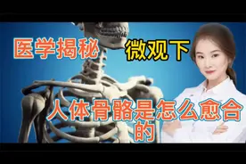 医学揭秘 微观下人体骨骼骨折后是如何自我愈合 揭秘人体的秘密视频封面
