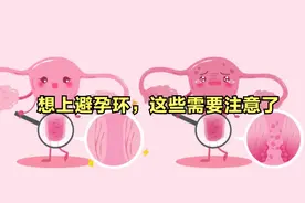 想上环？最佳放置时机和术后注意事项有哪些视频封面