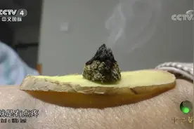 艾柱底下垫姜片还能治病？专家的解释让你彻底明白，一起听听吧