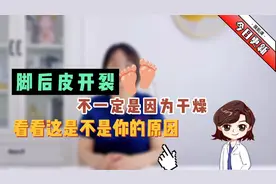 脚后皮开裂不一定是因为干燥，看看这是不是你的原因