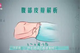 为保住手臂，大神医生惊人操作！居然把手埋进肚子里~