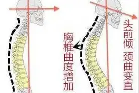 胸椎的姿势评估与解剖学分析