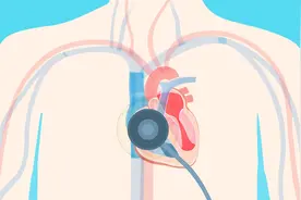 心脏有杂音是怎么回事？一般分为哪几种情况？视频封面