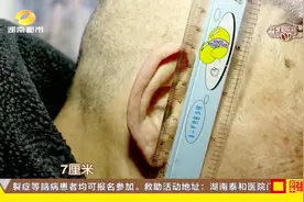 “耳朵大更长寿”，很多人都对此深信不疑，事实真的如此吗？