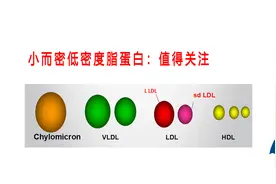 别老盯着低密度脂蛋白！"小而密"比大而轻低密度脂蛋白危害大？