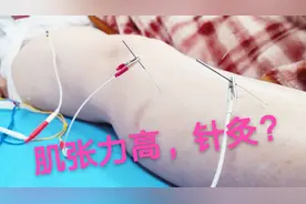 中风偏瘫后，患者肌张力增高，还需要针灸吗，听专业治疗师怎么说视频封面
