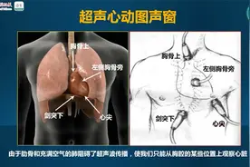 【零基础学心脏超声系列】5. 心脏超声的基本切面及正常值