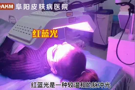 阜阳皮肤科医院-红蓝光治疗痤疮