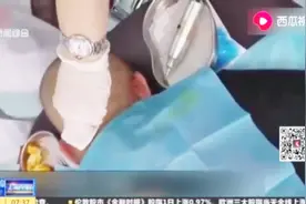 第一批90后已经脱发了！植发！你真的了解吗？好像并不安全！视频封面
