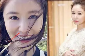 林心如鼻子怪异被质疑整容，本人发声否认：从出生以来就长这样视频封面