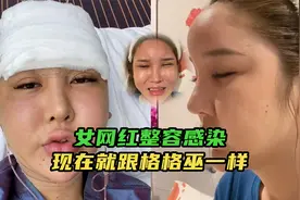 女网红整容感染，脸部肿到变形“毁容”，曾为整容骗走父亲20万视频封面
