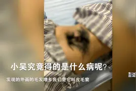 罕见！花季女孩染“怪病”后腰长出浓密毛发视频封面