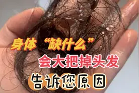 身体“缺”什么会大把掉头发？原因告诉您，秀发自己长出来