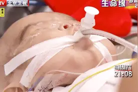 手术难度巨大，而孩子还要经历两次手术，他何时才能出院？视频封面