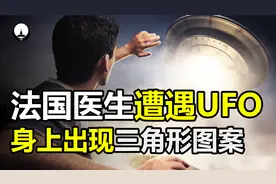 法国医生声称遭遇UFO，身上出现神秘“三角图案”，究竟是什么？视频封面