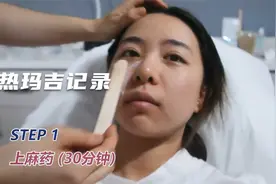 花2w做热玛吉值不值？美女做热玛吉30天效果，分享手术经验和过程视频封面