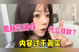 单身的朋友可能患有肌肤饥渴症？情侣贴贴不正常？内容过于真实！