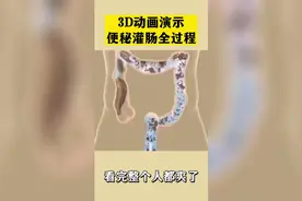 3D动画：便秘灌肠全过程