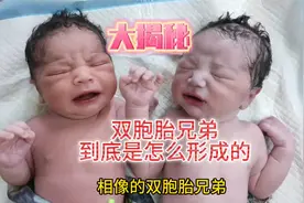 大揭秘 为什么双胞胎兄弟这么相像 但长大后性格迥异 原因在哪里