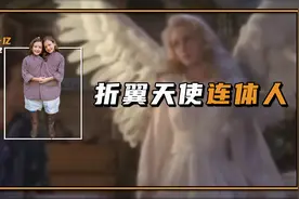 连体人是如何诞生的？其中一方死亡会影响另一方吗？视频封面