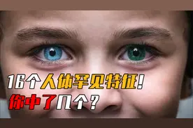 16个人体罕见特征你中了几个？拥有异色瞳孔的人，世界上不到1%？