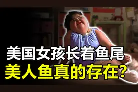美国女孩出生长着“鱼尾”，坚强活到10岁，“美人鱼”是真的？视频封面