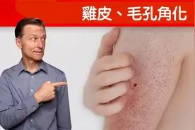 皮肤鸡皮 毛孔角化 自然疗法,柏格醫生 Dr Berg