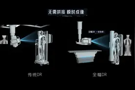 你见过一次拍全身的长DR吗？