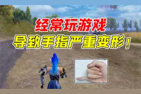 七妹揭秘：经常玩游戏竟然会导致手指严重变形！视频封面