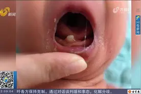 罕见！刚出生的婴儿嘴里竟然长出一颗牙齿，60小时后又自动脱落