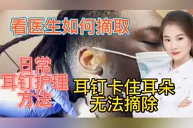医学实录 耳钉卡住耳朵 看医生如何摘取 日常护理耳钉很重要视频封面
