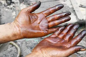 手上的核桃汁洗不掉，不要着急，试试这三个小妙招轻松解决