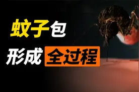 蚊子叮咬的包为什么这么痒？动画还原叮咬全过程！视频封面