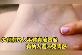 为何有的人手臂“青筋暴起”，有的人看不见青筋，哪种人更健康？视频封面