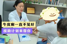【科普】牛皮癣一直不见好，“援助计划”来帮您视频封面