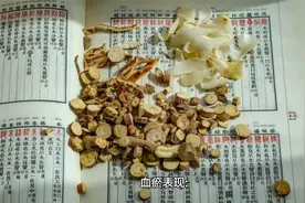 血瘀久治不愈好烦，中医送你“祛瘀八法”，给你的血管洗洗澡