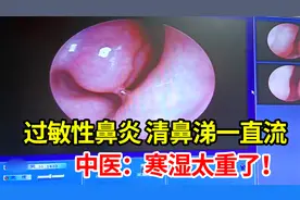 过敏性鼻炎冷空气过敏，清水鼻涕一直流，中医：你这必须要调体质视频封面