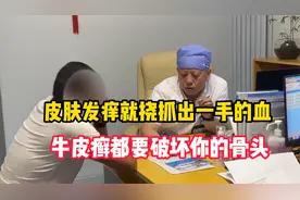 皮肤发痒就挠抓出一手的血，牛皮癣都要破坏你的骨头