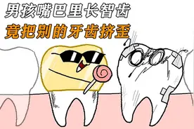 214. 男孩嘴巴里长智齿，竟把别的牙齿挤歪