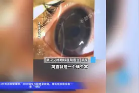 13岁男孩频繁揉眼，80只螨虫在眼睛里做窝视频封面