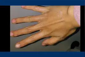 女人手如干姜“家道必昌”的手相