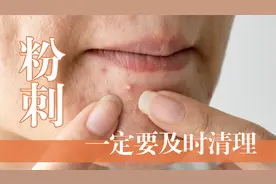 为什么粉刺一定要及时清理出