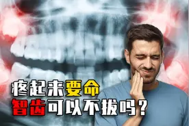 疼起来要命！为啥偏偏有的人不长智齿？智齿一定要拔掉吗？视频封面
