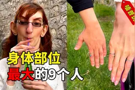 世界上身体部位最大的9个人，真是世界之大，没有最大只有更大！视频封面