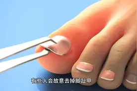 为什么一些马拉松运动员跑步前会去除脚指甲