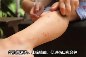 梓橦宫紫草软膏：创伤外伤必备良药