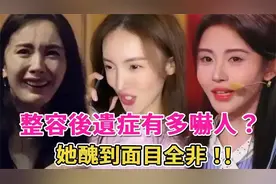 整容后遗症引关注：金晨鼻子歪斜，杨幂脸崩，鞠婧祎变化大