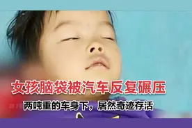 头骨到底有多硬？3岁女孩被汽车压过，竟奇迹存活视频封面