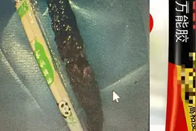 女子吞服502胶水一年后取出，残留物长度堪比筷子